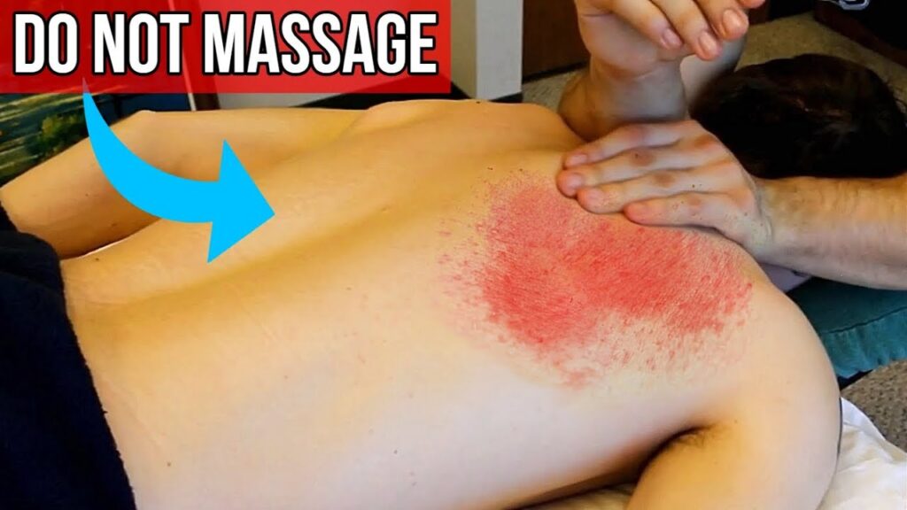 What Body Parts Should Not Be Massaged?