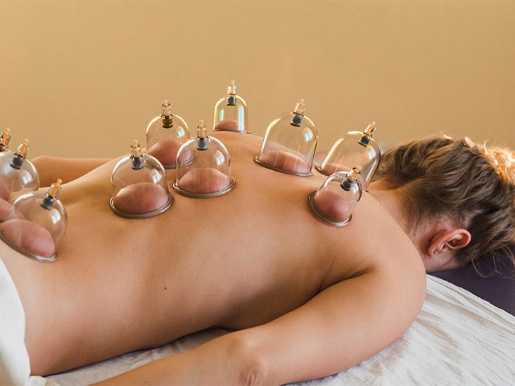 What Is Cupping Massage Used For